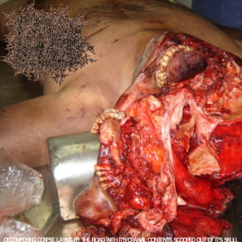 Enterococcal Infection of the Urinary Tract Causes Severe Urinary Incontinence - Decomposing Corpse Laying by the Road With It's Cranial Content(2013)