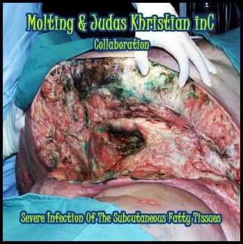 Molting & Judas Khristian inC - Severe Infection Of The Subcutaneous Fatty Tissues (2013)