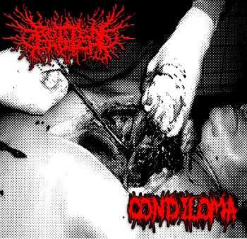 Condiloma & Rottencrotch - Split (2012)