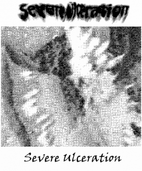 Severe Ulceration - Demo (2012)