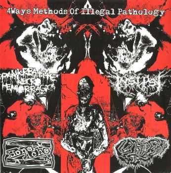Boneache & Pankreatite Necro Hemorragica & Fetal Deformity & Insepsy - 4 Ways Methods of Illegal Pathology (Split) (2013)