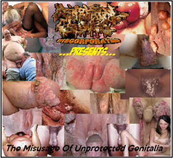 VA - Menstrual Chunks Discorporated - The Misusage of Unprotected Genitalia (2013)