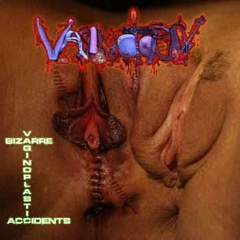 Vaginotopsy - Bizarre Vaginoplastic Accidents (2011)