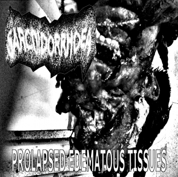 Sarcoidorrhoea - Prolapsed Edematous Tissues (Demo) (2014)