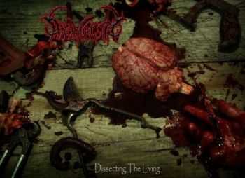 Anomalistic - Dissecting The Living (2014)