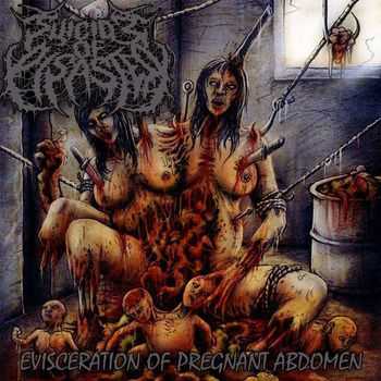 Suicide Of Disaster - Evisceration Of Pregnant Abdomen (2014)