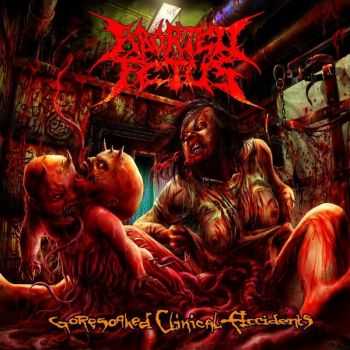 Aborted Fetus - Goresoaked Clinical Accidents (Re-Recording) (2012)  