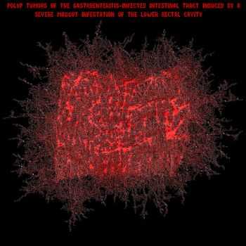 Necrotizing Intravenous Conditions - Polyp Tumors of the Gastroenteritis-Infected Intestinal Tract Induced by a Severe Maggot Infestation of the Lower Rectal Cavity (EP) (2013)