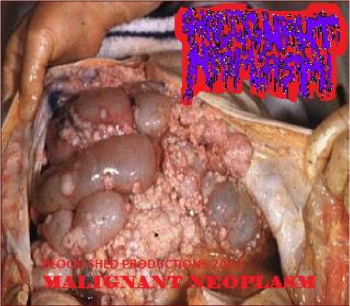 Malignant Neoplasm - Demo (2013)