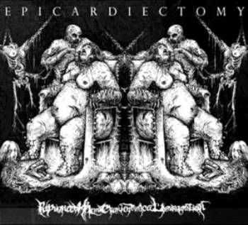 Epicardiectomy - Repugnant Hemicraniotomical Ingurgitation (Demo) (2015)