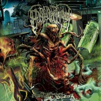 Epicardiectomy - Putreseminal Morphodysplastic Virulency (2014)