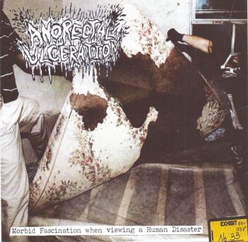 Anorectal Ulceration - Morbid Fascination when viewing a Human Disaster (2018)