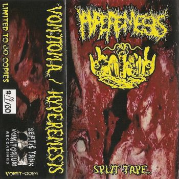 Vomitoma / Hyperemesis - Split Tape (2011)