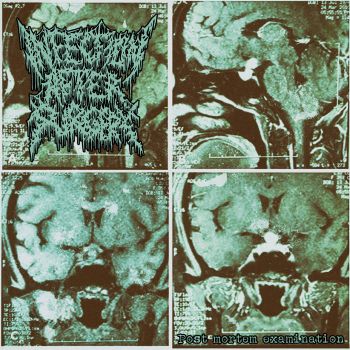 Infection After Surgery - Post Mortem Examination (2019)