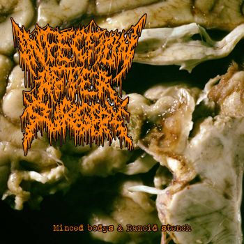 Infection After Surgery - Minced Bodys and Rancid Stench (2019)