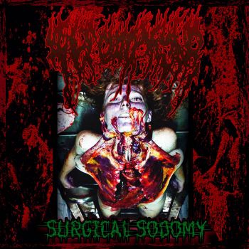 AeteratomA - Surgical Sodomy (2019)