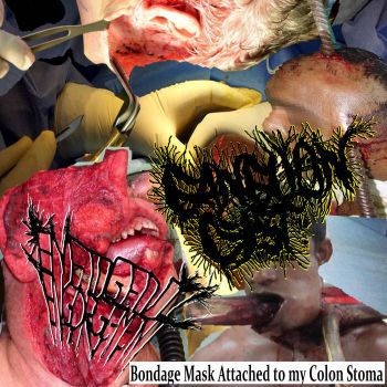 Emetogenic Engorgement / Ganglion Cyst - Bondage Mask Attached to My Colon Stoma (2019)