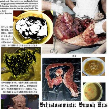 Uterovaginal Analysis of a Decomposing Jane Doe / Ganglion Cyst - Schistosomiatic Smash Hits (2019)