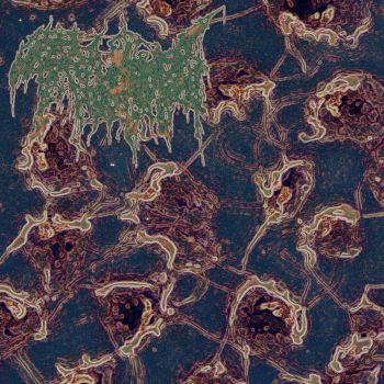 Trichomoniasis - Terminal Inversion (2019)