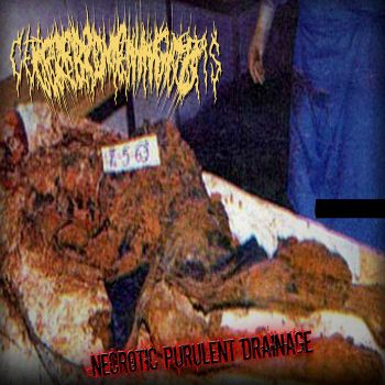Cerebromeningitis - Necrotic Purulent Drainage (2020)