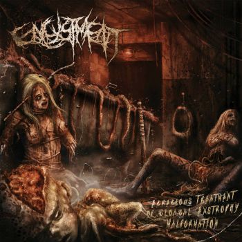 Encystment - Egregious Treatment of Cloacal Extrophy Malformation (2020)