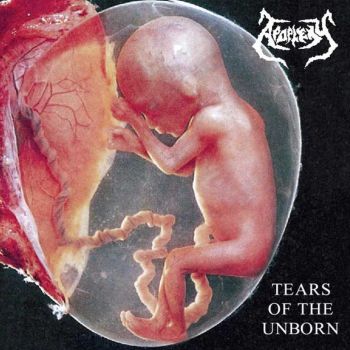 Apoplexy - Tears Of The Unborn (1995)