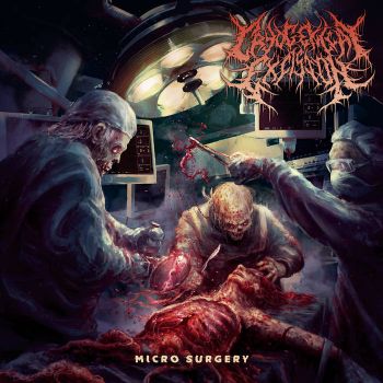 Cryogenical Excision - Micro Surgery (2020)