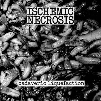 Ischemic Necrosis - Cadaveric Liquefaction (2020)