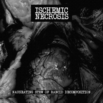 Ischemic Necrosis - Nauseating Stew of Rancid Decomposition (2021)