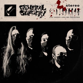 General Surgery - Lay Down and Be Counted (2021)