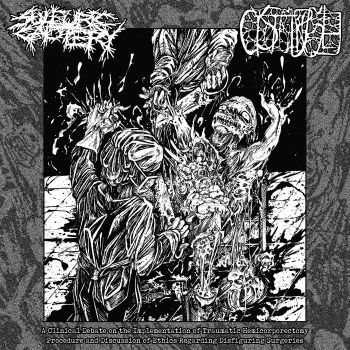 Sulfuric Cautery / Cystgurgle - A Clinical Debate on the Implementation of Traumatic Hemicorporectomy Procedure and Discussion of Ethics Regarding Disfiguring Surgeries (2021)