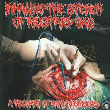 Inhaling the Stench of Mustard Gas - A Tsunami of Brain Tumours (2020)