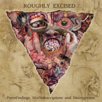Lymphatic Phlegm - Roughly Excised - Putrefindings, Morbidescriptions and Necrognoses (2021)