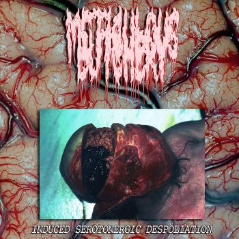 Meticulous Butchery - Induced Serotonergic Despoliation (2021)