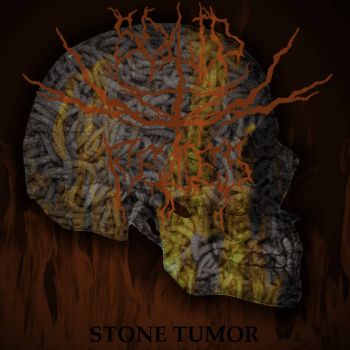 Solid Feces - Stone Tumor (2021)