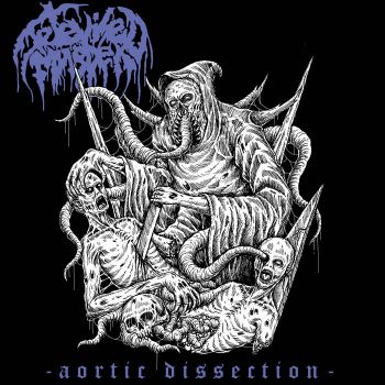 Televised Murder - Aortic Dissection (2021)