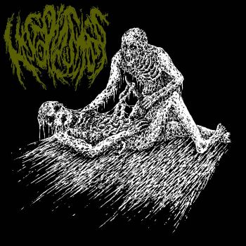Histoplasmosis - Histoplasmosis (2021)