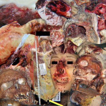 Forensic Malpractice - Forensic Malpractice (2022)