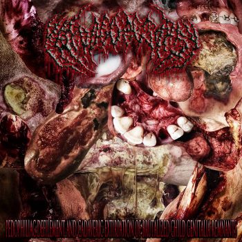 Paedogoretopsy - Pedophiliac Defilement and Cadaveric Extirpation of Brutalized Child Genitalia Remnants (2022)
