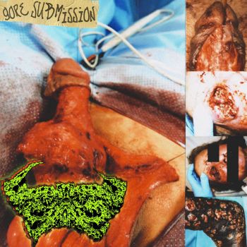Pneumonoultramicroscopicsilicovolcanoconiosis - Gore Submission (2022)