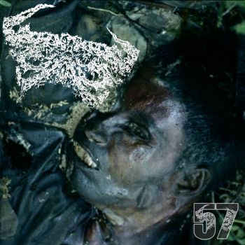 Pneumonoultramicroscopicsilicovolcanoconiosis - 57 (2022)