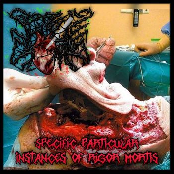 Seizure Stomp - Specific Particular Instances of Rigor Mortis (2022)