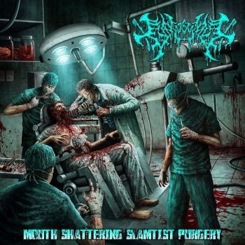 Gingivectomy - Mouth Shattering Slamtist Purgery (2022)