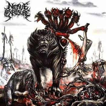 Nerve Exposure - The Spinal Offering (2022)