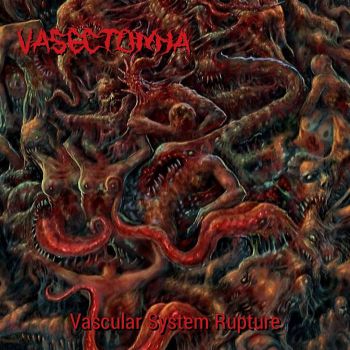 Vasectomya - Vascular System Rupture (2022)