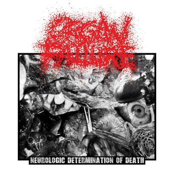 Organ Failure - Neurologic Determination of Death (2022)