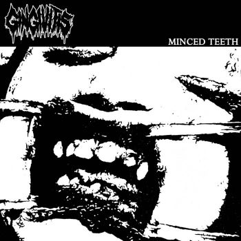 Gingivitis - Minced Teeth (2022)