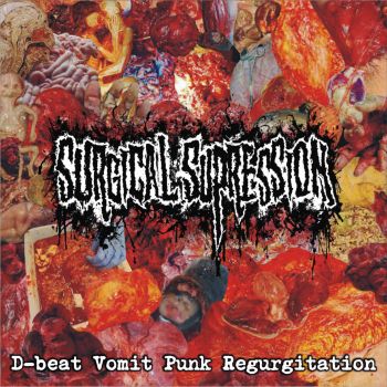 Surgical Supression - D-Beat Vomit Punk Regurgitation (2020)