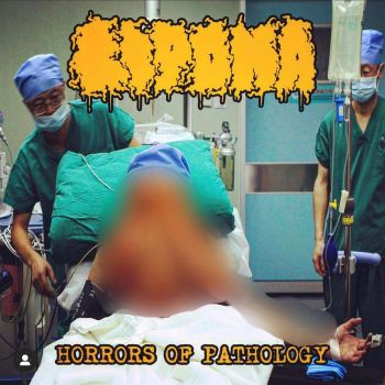 Lipoma - Horrors of Pathology (2022)