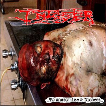 Infester - ...To Anatomize & Dissect... (2022)